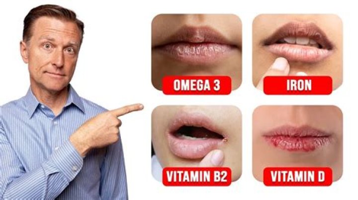 Are chapped lips a sign of vitamin deficiency?