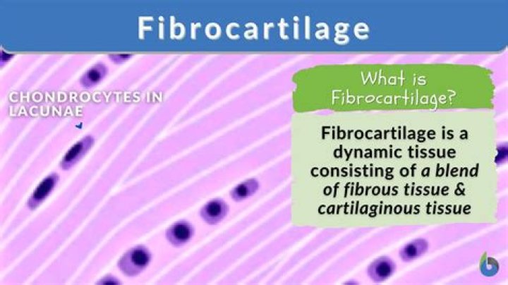 Are formed of fibrocartilage?