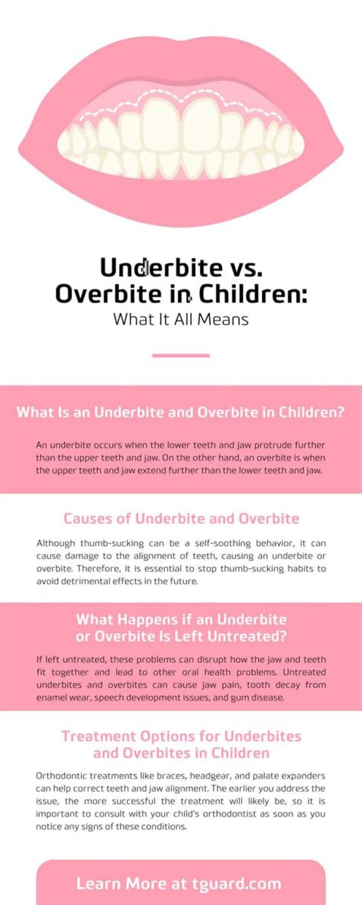 Are underbites common in babies?