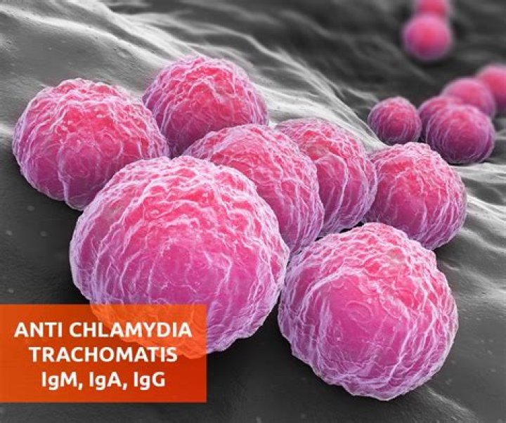 At chlamydia trachomatis igg?