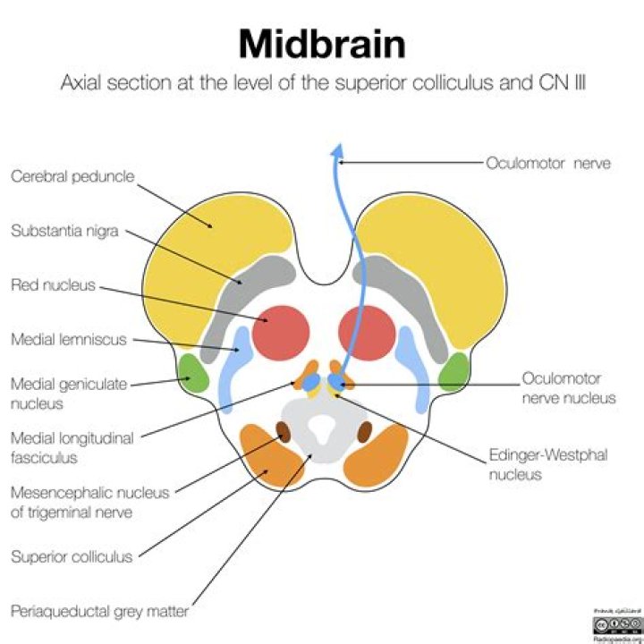 At the midbrain level?