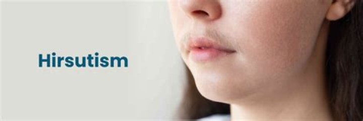At what age does hirsutism start?