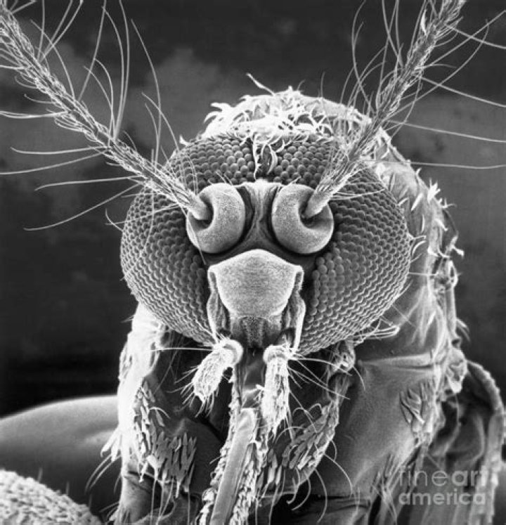 By scanning electron microscope?