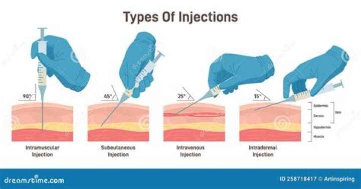 Can an acupuncturist give injections?