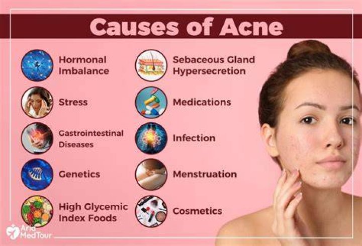 Can deficiencies cause acne?