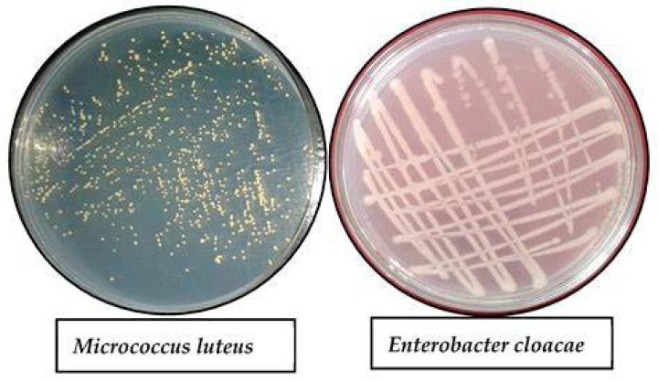 Can enterobacter cloacae be an esbl?