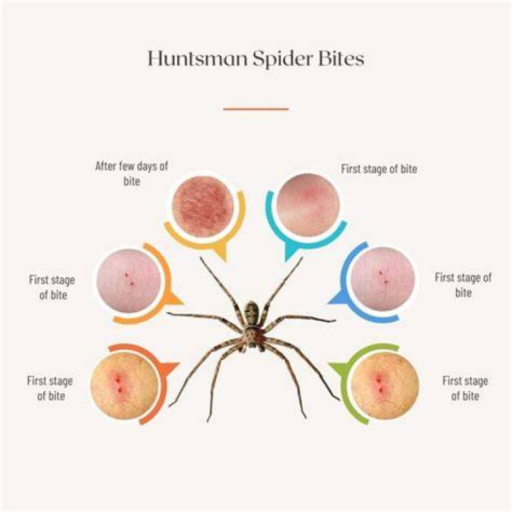 Can huntsman spiders bite?