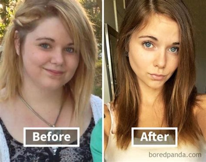 Can losing weight make you look younger?