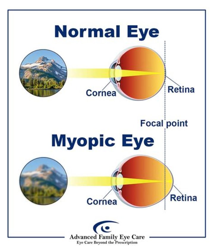 Can presbyopia lead to blindness?