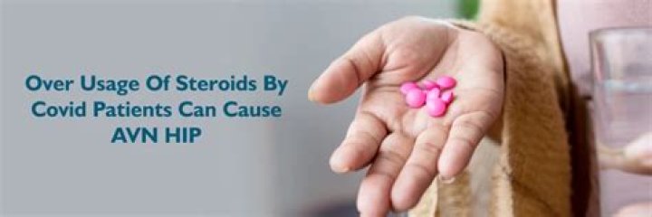 Can steroids cause avn?