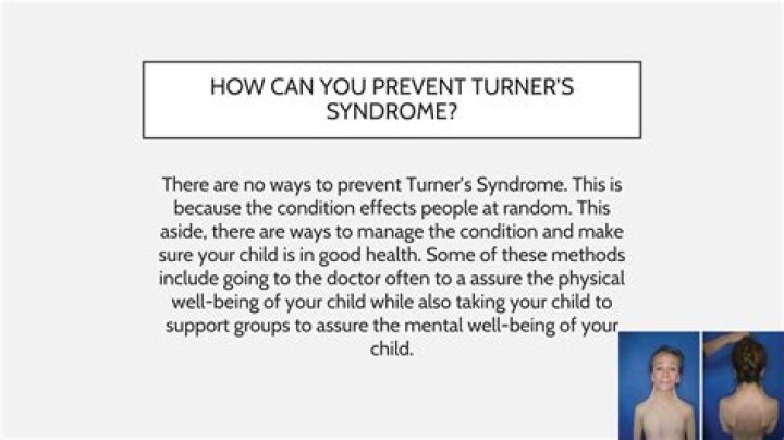 Can turner syndrome be prevented?