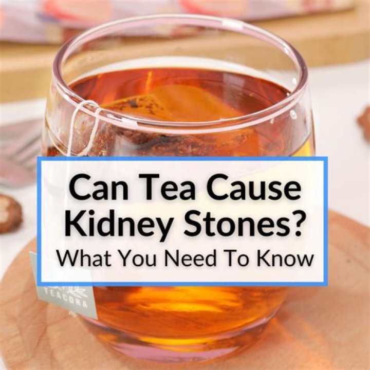 Can unsweet tea cause kidney stones?