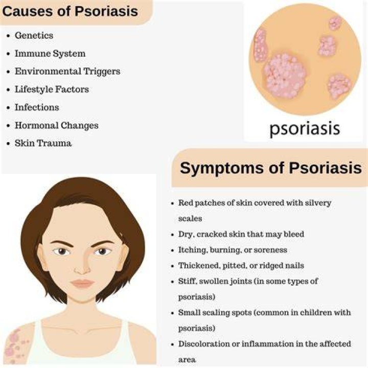 Can you catch psoriasis skin disease?