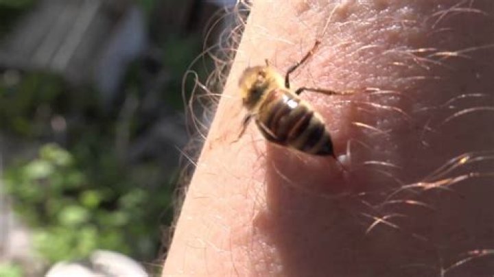 Can you die from bee stings?