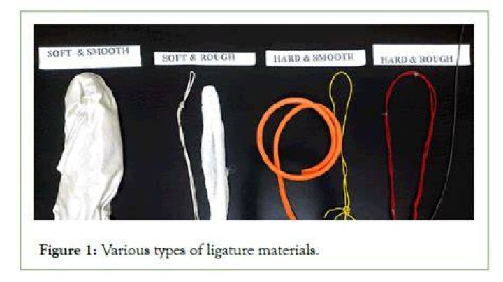 Can you make a ligature?