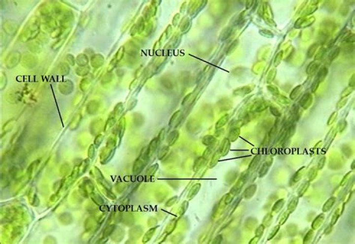 Can you see nuclei in elodea cells?