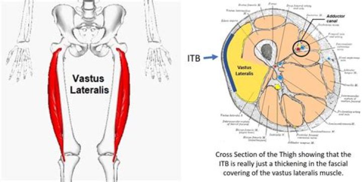 Can you tear your vastus lateralis?