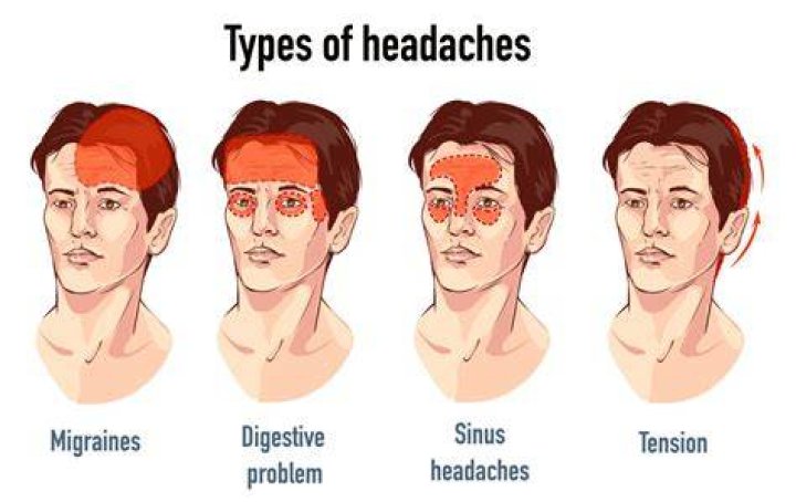 Could cataracts cause headaches?