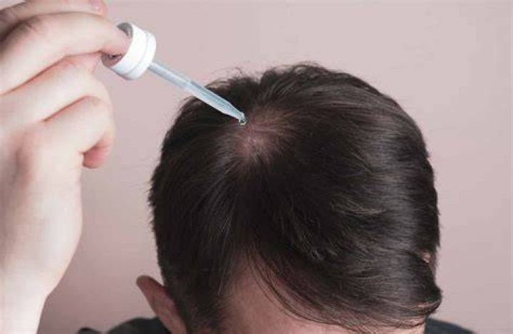 Could hair loss be a side effect of covid?
