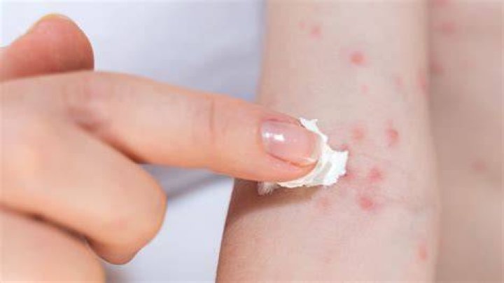 Could i be allergic to coffee creamer?