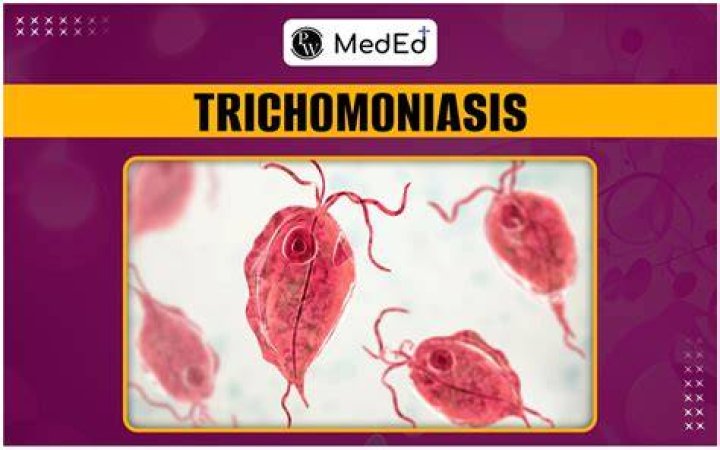 Could trichomoniasis kill you?