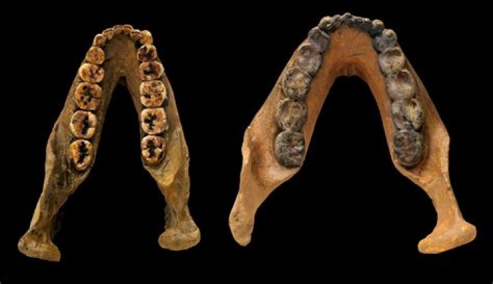 Did cavemen have tooth decay?