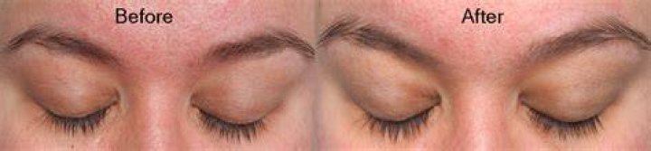 Do eyelash serums work?