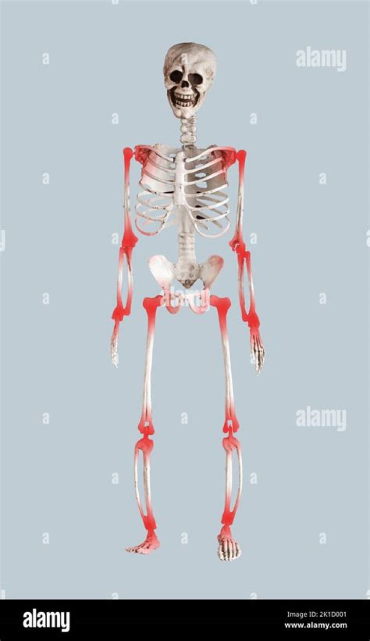 Do previously broken bones ache?