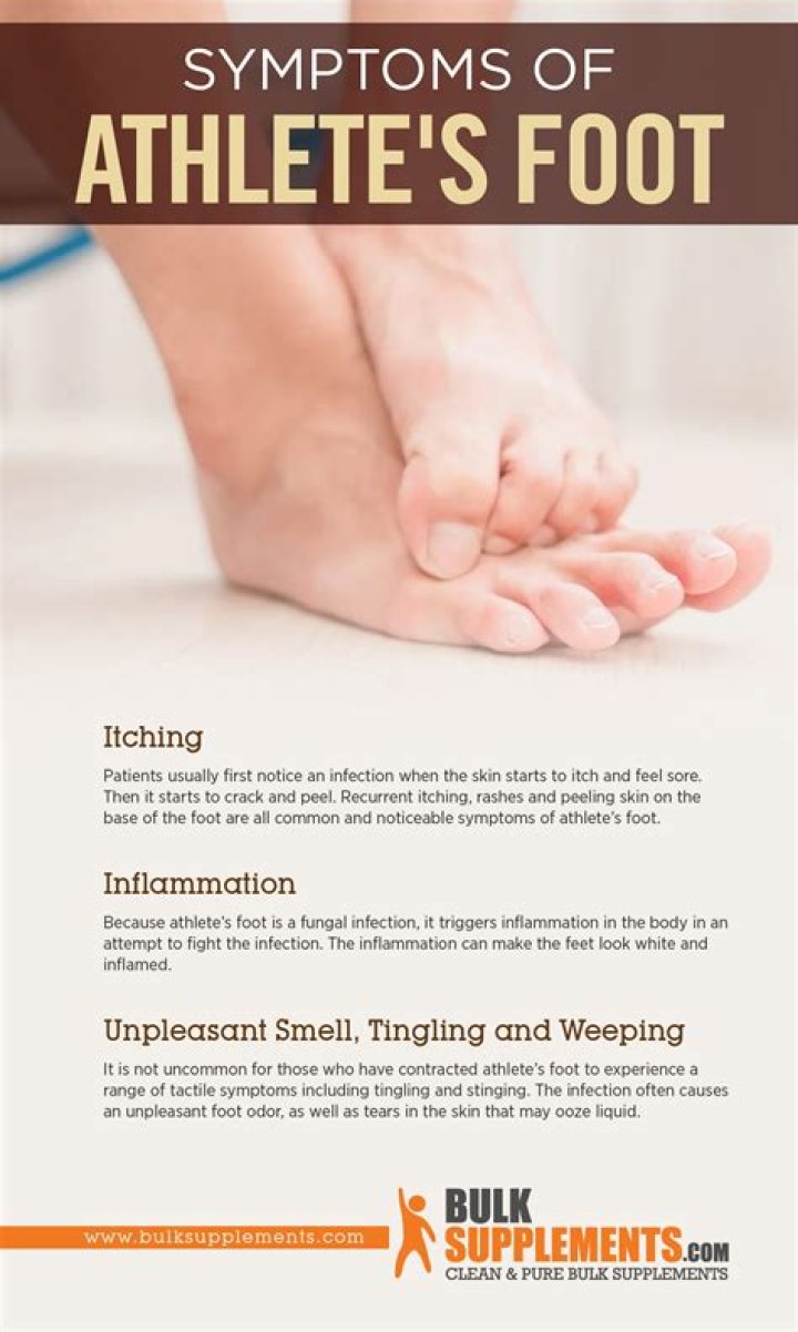 Does athlete's foot smell?