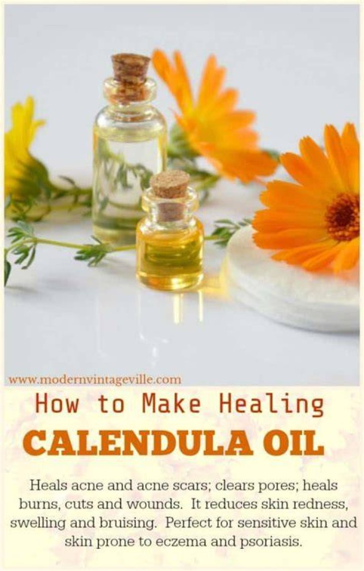 Does calendula help acne?
