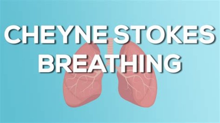 Does cheyne stokes breathing come and go?