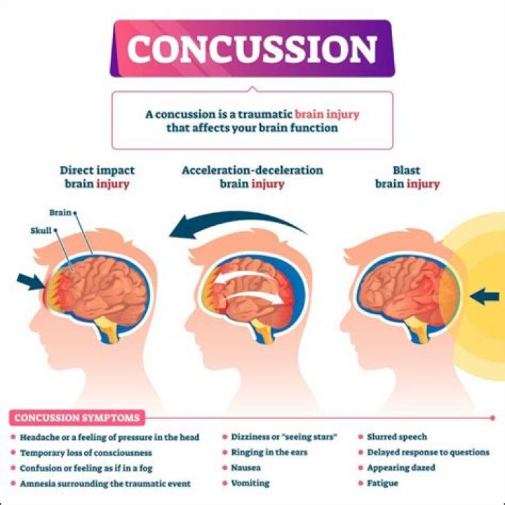 Does concussions cause autism?