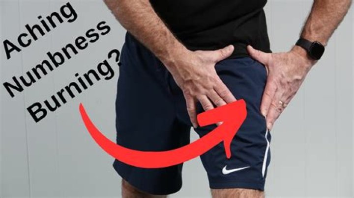Does exercise help paresthesia?