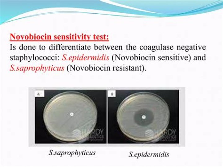 Does novobiocin kill staphylococcus epidermidis?
