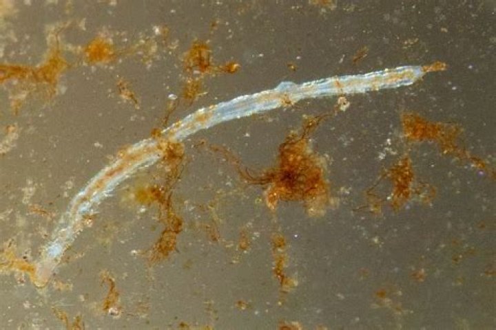 Does salt kill detritus worms?