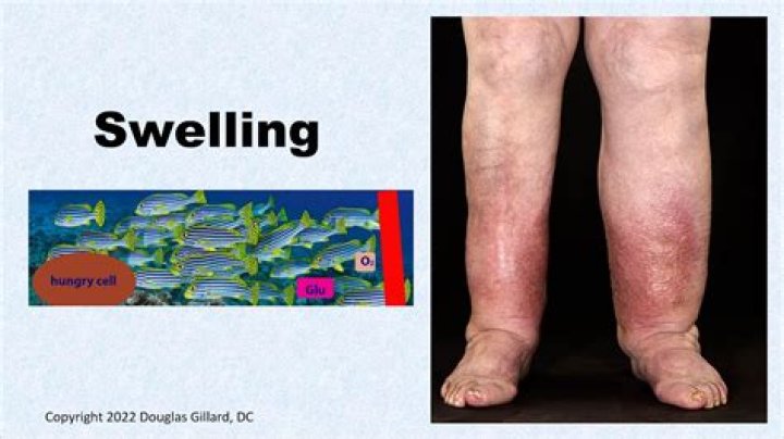 Does swelling mean inflammation?