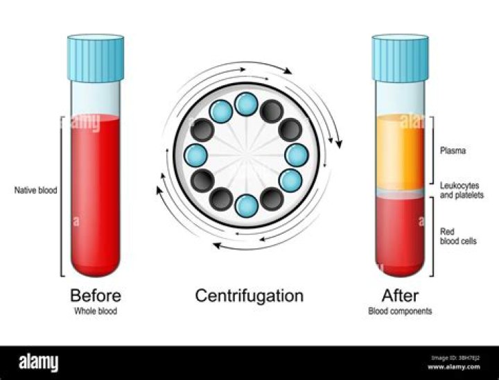 During centrifugation which settled down last?