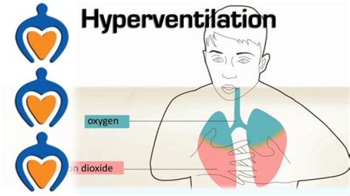 During hyperventilation what happens to the concentration of h+ ions?