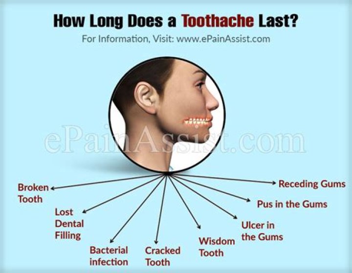 For how long can a toothache last?