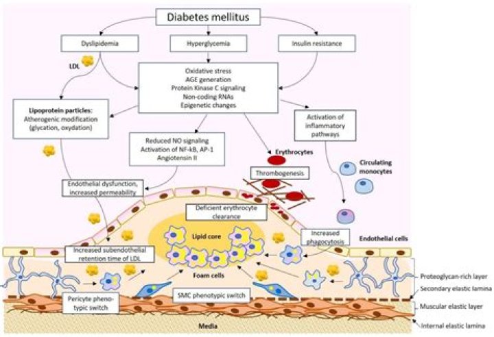 How diabetes mellitus causes atherosclerosis?