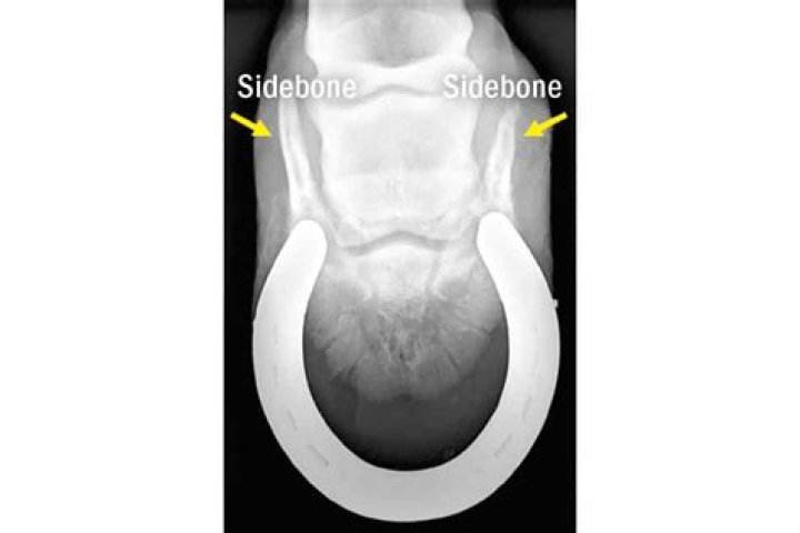 How do you treat sidebone in horses?