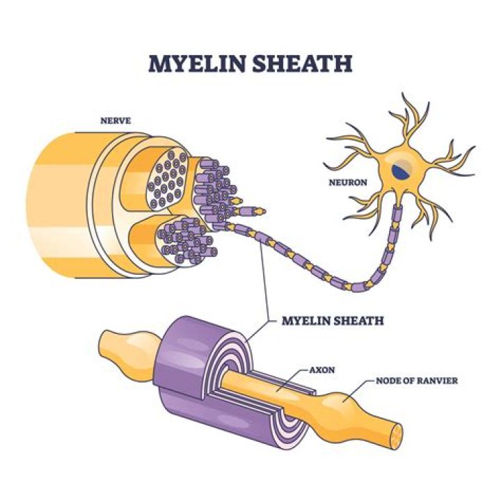How does demyelination affect the nervous system?