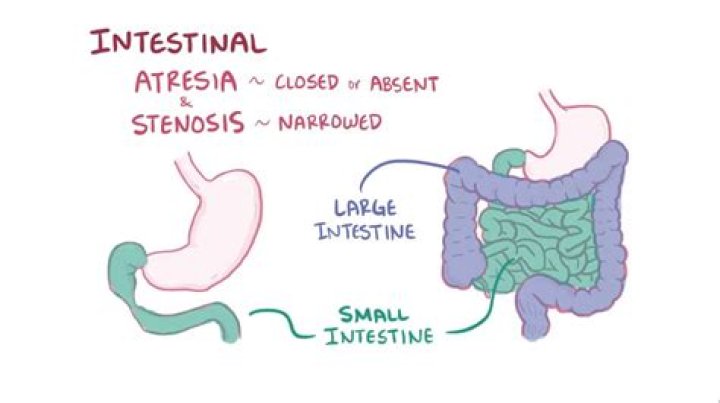 How is atresia caused?