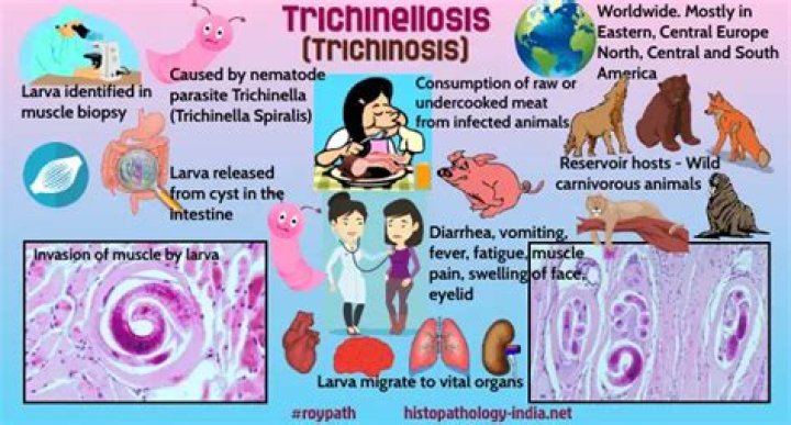 How is trichinella infection acquired?