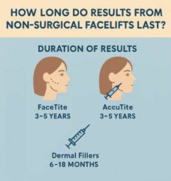 How long do facelifts last?