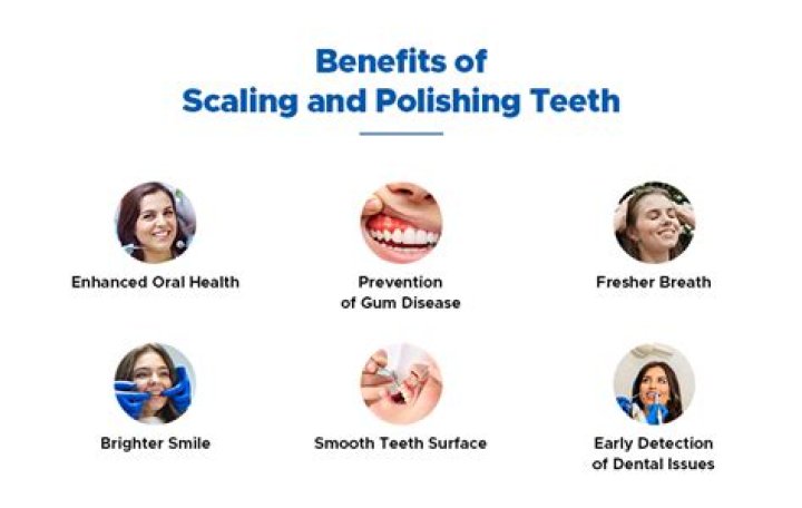 How often to do scaling and polishing?