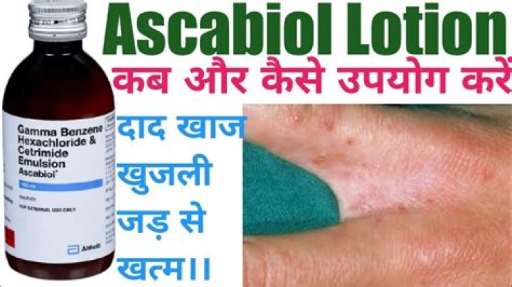 How to apply ascabiol lotion?