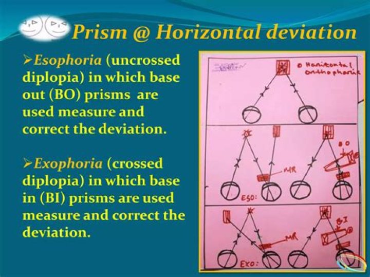 How to correct exophoria with prism?