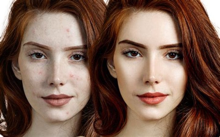 How to get rid of sallow skin?