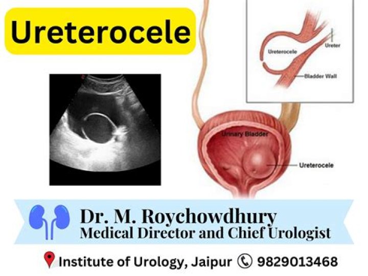 How to remove ureterocele?